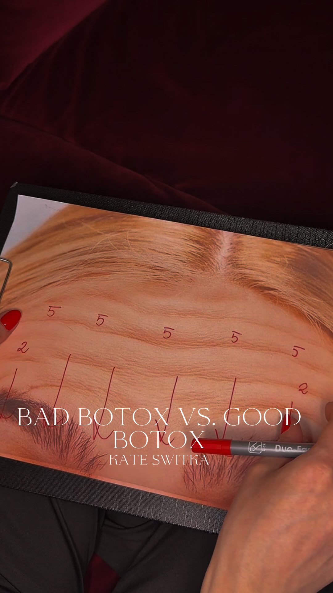 Photo by doc.kateswitka