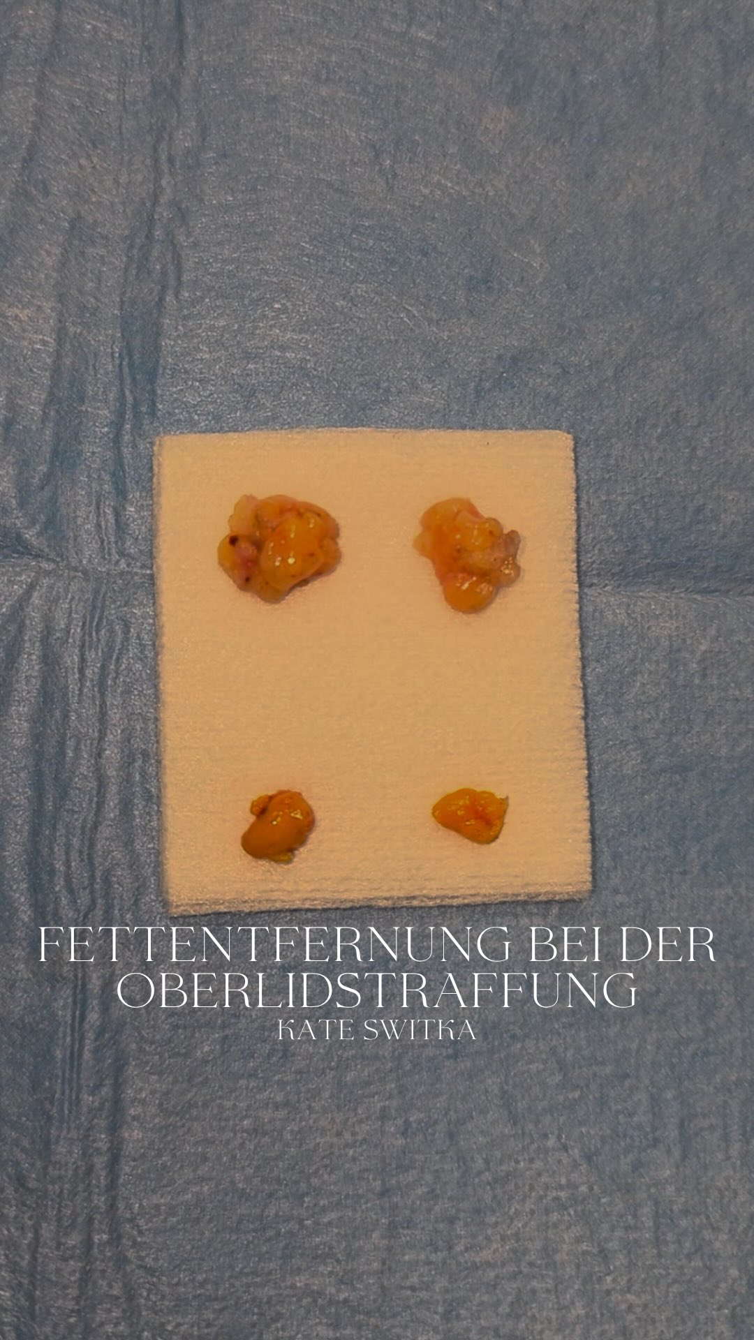 Photo by doc.kateswitka